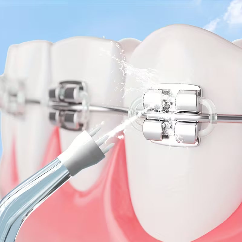 Portable Oral Irrigator/ 360° Rotatable Nozzles, USB Charging, Lithium Battery, Suitable for Men and Women's Daily Dental Care & Gum Cleaning, Multicolor.