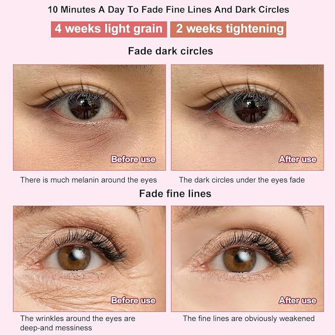 Eye Beauty Device/ Eye Beauty Device, Anti-Wrinkle Red&Blue Light Therapy Wand for Eyes and Face Facial Wand Face Lift, Portable Skincare Wands for Radiant Skin On The Go, Multicolor.