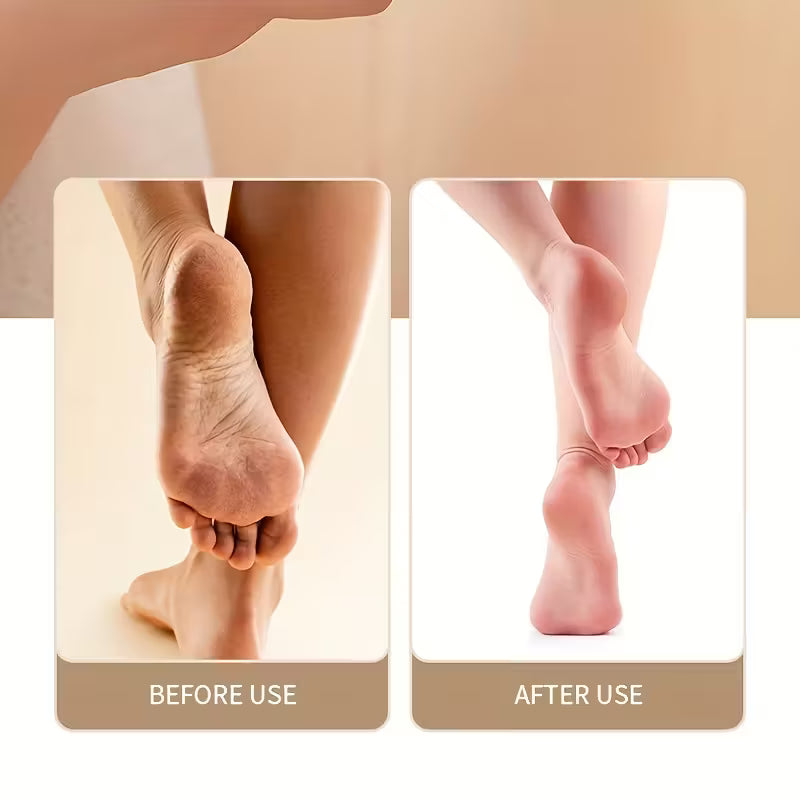 Electric Pedicure Foot File Callus Remover/ Painless Exfoliator with Removable Heads, Operation for thick Heels, Toenails, Hands & Fingers, Ideal for diabetics Men & Women.