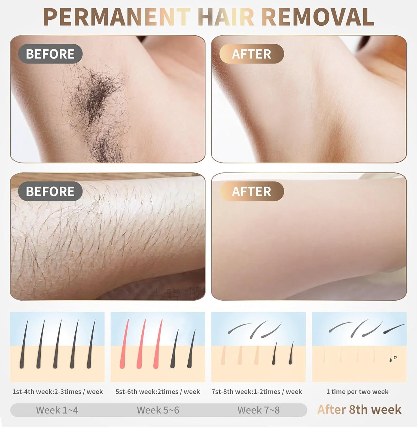 Mini Laser Hair Removal/ Portable Latest IPL Laser Hair Removal Tech with 2 Flashes Modes And 5 Adjustable Energy Levels, Multicolor.